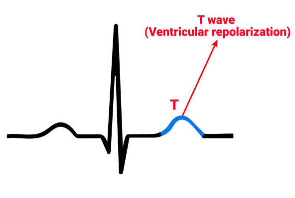 0 تا 100 رپولارریزاسیون-Repolarization